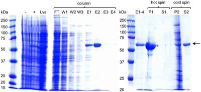 Bet v 1-displaying elastin-like polypeptide nanoparticles induce a strong humoral and weak CD4+ T-cell response against Bet v 1 in a murine immunogenicity model